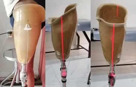 Strides Healthcare And Artificial Limbs