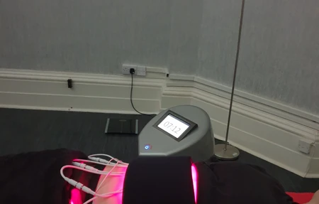 Strawberry Laser Uk